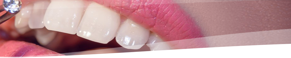 FOGÉKSZER FELHELYEZÉSE